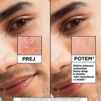 GAR SalicylicSerum 1x1 02